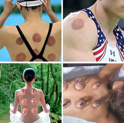 Set med 12 massagekoppar - lindrar muskel och ledvärk